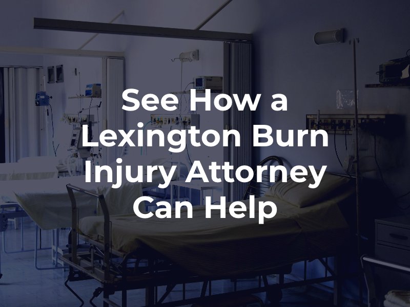 See How a Lexington Burn Injury Attorney Can Help