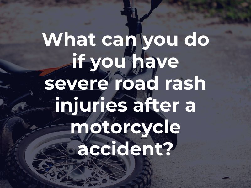What can you do if you have severe road rash injuries after a motorcycle accident?